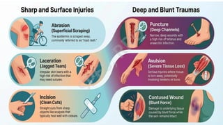 Comprehensive Guide to Common Sports Injuries and First Aid Management ...