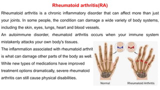 Rheumatoid arthritis(RA)
Rheumatoid arthritis is a chronic inflammatory disorder that can affect more than just
your joints. In some people, the condition can damage a wide variety of body systems,
including the skin, eyes, lungs, heart and blood vessels.
An autoimmune disorder, rheumatoid arthritis occurs when your immune system
mistakenly attacks your own body's tissues.
The inflammation associated with rheumatoid arthritis
is what can damage other parts of the body as well.
While new types of medications have improved
treatment options dramatically, severe rheumatoid
arthritis can still cause physical disabilities.
 