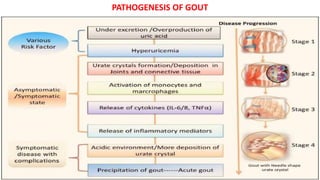 PATHOGENESIS OF GOUT
 