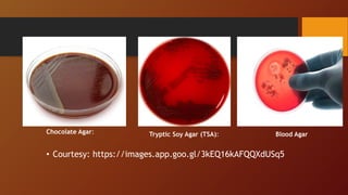 • Tryptic Soy Agar (TSA):
Chocolate Agar: Tryptic Soy Agar (TSA): Blood Agar
• Courtesy: https://images.app.goo.gl/3kEQ16kAFQQXdUSq5
 