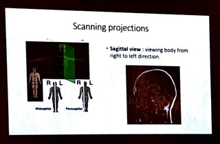 Ro
Midsagittal
Scanning projections
R.L
Parasagita
"Sagittal view : viewing body from
right toleft direction.
 