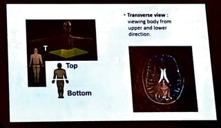 T
Top
Bottom
"Transverse view :
viewing body from
upper and lower
direction.
 