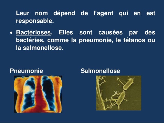 Unité 5. les maladies infectieuses (4)