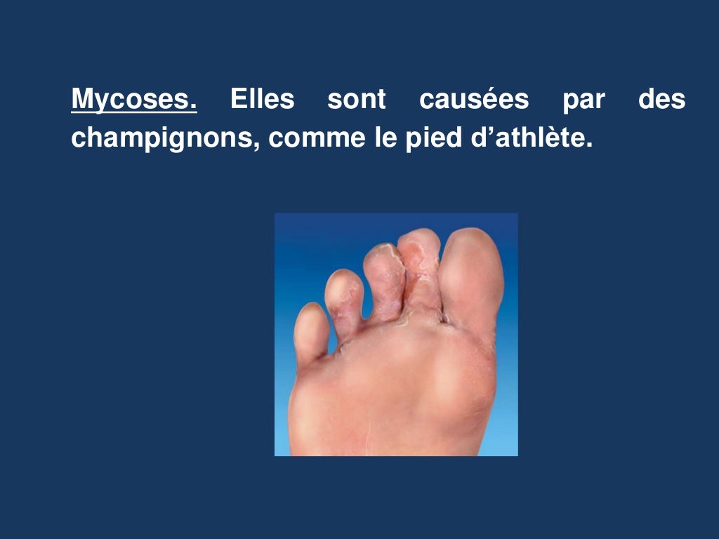 Unité 5. les maladies infectieuses (4)