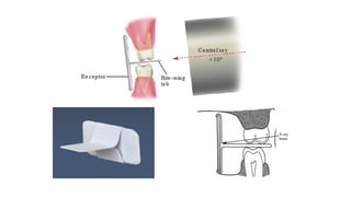 Comprehensive Guide to Bitewing X-Ray Procedure in Dentistry | PPTX