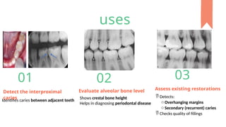 Procedure Bitewing Comprehensive Guide to Bitewing X-Ray Procedure in Dentistry | PPTX