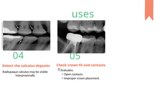 Comprehensive Guide to Bitewing X-Ray Procedure in Dentistry | PPTX