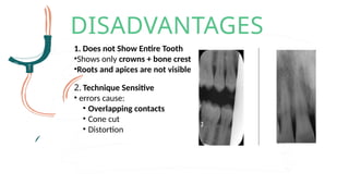 Procedure Bitewing Comprehensive Guide to Bitewing X-Ray Procedure in Dentistry | PPTX