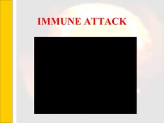 IMMUNE ATTACK 