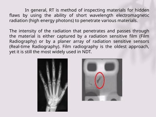 Sensitivity Radiography Comprehensive Overview of Non-Destructive Testing: Radiography and ...