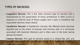 TYPES OF NECROSIS:
• Coagulative Necrosis: This is the most common type of necrosis and is
characterized by the preservation of tissue architecture. It often occurs in
response to ischemia (lack of blood supply) and is seen in conditions like
myocardial infarction (heart attack).
• Liquefactive Necrosis: In liquefactive necrosis, the affected tissue becomes
liquefied due to the action of enzymes and immune cells. It is commonly
associated with bacterial infections and is often seen in the brain during
abscess formation.
• Caseous Necrosis: This type of necrosis results in a cheese-like, soft, and
granular appearance of the affected tissue. It is commonly found in
 