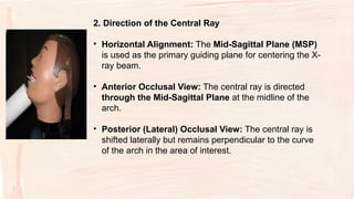 Comprehensive Guide to Occlusal Radiographs in Oral Radiology | PPTX