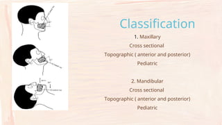 Comprehensive Guide to Occlusal Radiographs in Oral Radiology | PPTX