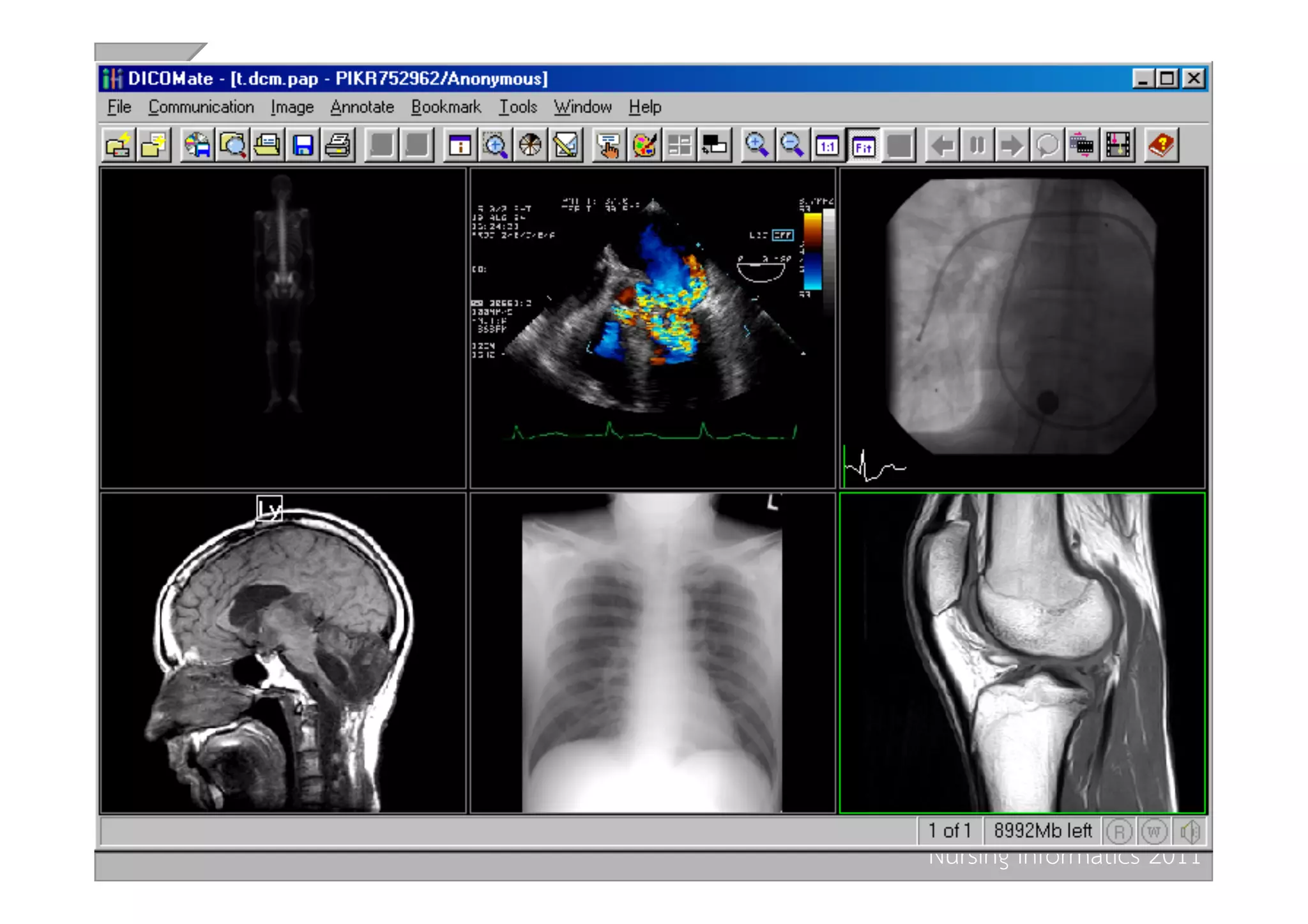 Nursing Informatics 2011 
 