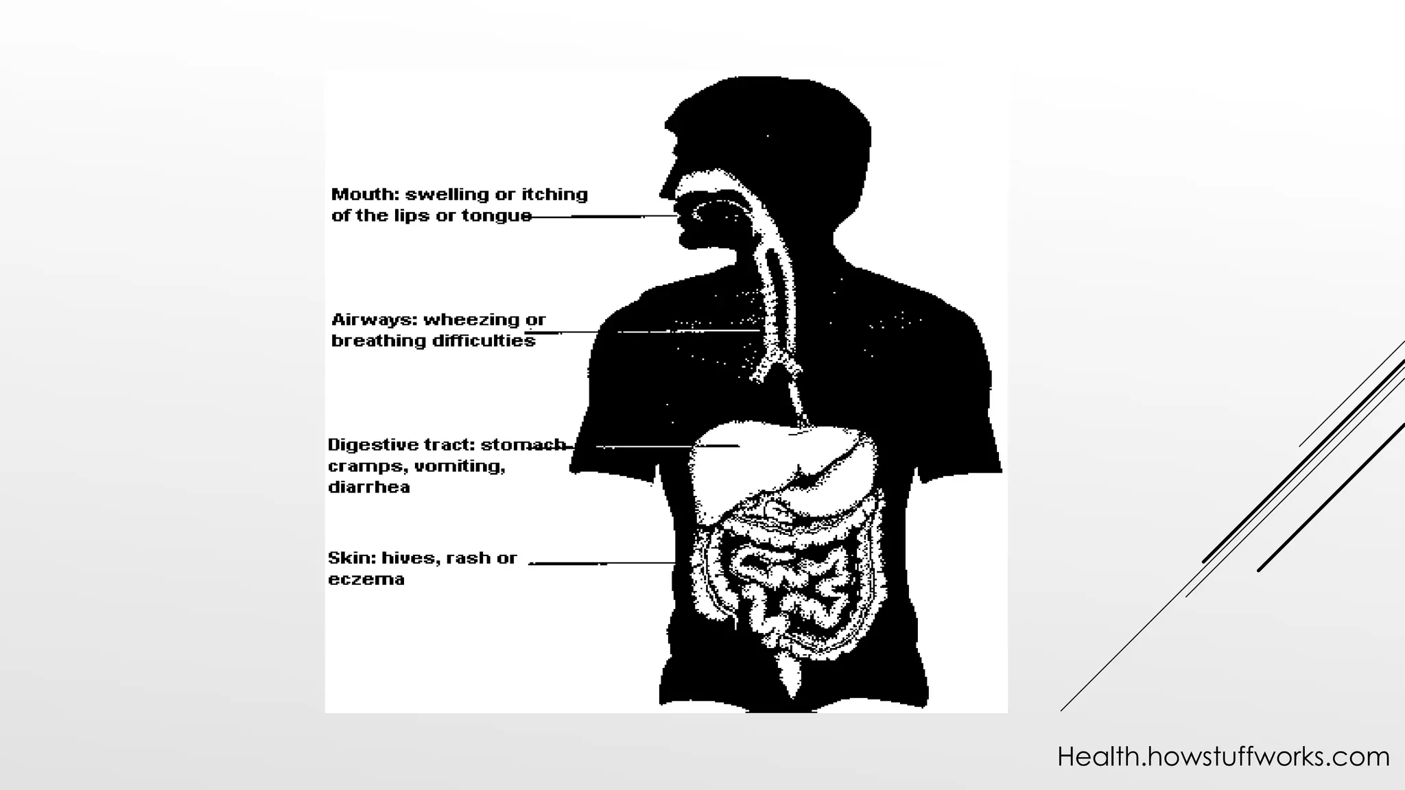 Health.howstuffworks.com
 