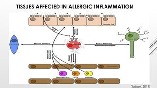 TISSUES AFFECTED IN ALLERGIC INFLAMMATION
(Saban, 2011)
 