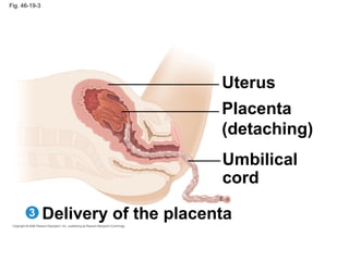 Fig. 46-19-3
Delivery of the placenta
Uterus
Placenta
(detaching)
Umbilical
cord
3
 