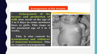 Normal Neonates | PPTX