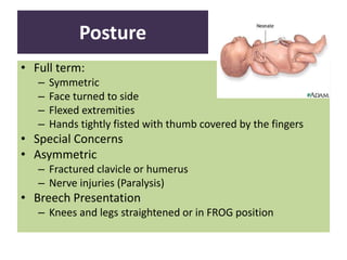 Posture
• Full term:
– Symmetric
– Face turned to side
– Flexed extremities
– Hands tightly fisted with thumb covered by the fingers
• Special Concerns
• Asymmetric
– Fractured clavicle or humerus
– Nerve injuries (Paralysis)
• Breech Presentation
– Knees and legs straightened or in FROG position
 