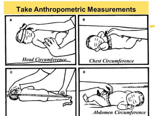 ANTHROPOMETRIC
MESUREMENTS
 
