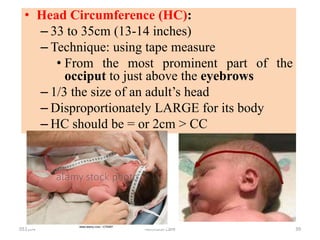051104 Neonatal Care 39
• Head Circumference (HC):
– 33 to 35cm (13-14 inches)
– Technique: using tape measure
• From the most prominent part of the
occiput to just above the eyebrows
– 1/3 the size of an adult’s head
– Disproportionately LARGE for its body
– HC should be = or 2cm > CC
 