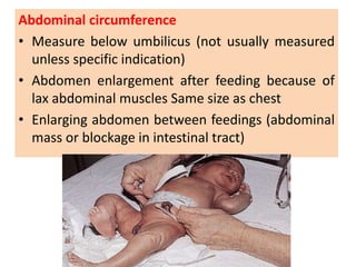 Abdominal circumference
• Measure below umbilicus (not usually measured
unless specific indication)
• Abdomen enlargement after feeding because of
lax abdominal muscles Same size as chest
• Enlarging abdomen between feedings (abdominal
mass or blockage in intestinal tract)
 