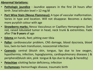Abnormal Variations:
• Pathologic jaundice : Jaundice appears in the first 24 hours after
birth .Total bilirubin level > 12 mg/dl
• Port Wine Stain (Nevus Flammeus): A type of vascular malformation.
Varies in type and location. Will not disappear. Becomes a darker,
more purplish colour with age
• Strawberry marks: Nevus Vasculosus or Capillary Hemangioma. Dark
red, raised lobulated tumor in head, neck trunk & extremities. Fade
after 7 to 9 years of age
• Edema on hands, feet; pitting over tibia
• Pallor: cardiovascular problem, CNS damage, blood dyscrasia, blood
loss, twin-to-twin transfusion, nosocomial infection
• Cyanosis: central (bluish skin, tongue, lips due to low oxygen,
hypothermia, infection, hypoglycemia, cardiopulmonary diseases ) &
peripheral(bluish skin, pink tongue & lips due to drugs & heredity)
• Petechiae :clotting factor deficiency, infection
• Ecchymoses :hemorrhagic disease, traumatic birth
 