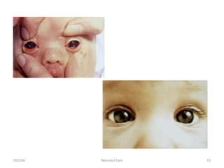 051104 Neonatal Care 53
 