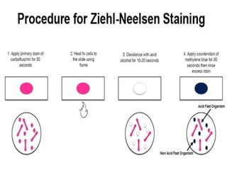 Staining used in bacteriology for CMLT level | PPTX