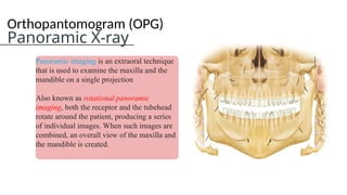 Opg Radiology Orthopantomogram (OPG) Panoramic X-ray Imaging in Dentistry | PPTX