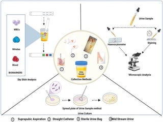 Unit 8 Sample collection for the diagnosis of bacterial infections | PPTX