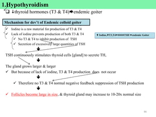 1.Hypothyroidism
 thyroid hormones (T3 & T4)endemic goiter
Mechanism for dev’t of endemic colloid goiter
 Iodine is a raw material for production of T3 & T4
 Lack of iodine prevents production of both T3 & T4
 No T3 & T4 to inhibit production of TSH
 Secretion of excessively large quantities of TSH

TSH continuously stimulates thyroid cells [gland] to secrete TH,

The gland grows larger & larger
 But because of lack of iodine, T3 & T4 production does not occur

 Therefore no T3 & T4 normal negative feedback suppression of TSH production

 Follicles become large in size, & thyroid gland may increase to 10-20x normal size
86
 Iodine,T3,T4TSH endemic Goiter
1.Hypothyroidism
Mechanism for dev’t of Endemic colloid goiter
 