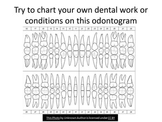 Try to chart your own dental work or
conditions on this odontogram
 