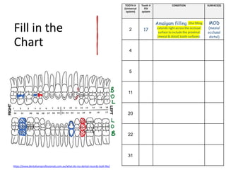 Fill in the
Chart
https://www.dentalcareprofessionals.com.au/what-do-my-dental-records-look-like/
TOOTH #
(Universal
system)
Tooth #
FDI
system
CONDITION SURFACE(S)
2 17
Amalgam filling (the filling
extends right across the occlusal
surface to include the proximal
[mesial & distal] tooth surfaces)
MOD
(mesial
occlusal
distal)
4
5
11
20
22
31
 