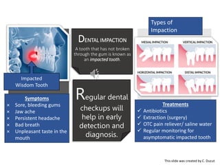DENTAL IMPACTION
A tooth that has not broken
through the gum is known as
an impacted tooth.
Regular dental
checkups will
help in early
detection and
diagnosis.
Treatments
 Antibiotics
 Extraction (surgery)
 OTC pain reliever/ saline water
 Regular monitoring for
asymptomatic impacted tooth
Types of
Impaction
Symptoms
× Sore, bleeding gums
× Jaw ache
× Persistent headache
× Bad breath
× Unpleasant taste in the
mouth
Impacted
Wisdom Tooth
This slide was created by C. Ducut
 