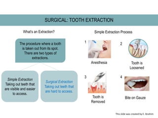 SURGICAL: TOOTH EXTRACTION
What’s an Extraction?
The procedure where a tooth
is taken out from its spot.
There are two types of
extractions.
Simple Extraction
Taking out teeth that
are visible and easier
to access.
Surgical Extraction
Taking out teeth that
are hard to access.
Anesthesia Tooth is
Loosened
Tooth is
Removed
Bite on Gauze
Simple Extraction Process
1 2
3 4
This slide was created by E. Ibrahim
 