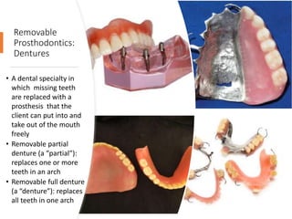 Removable
Prosthodontics:
Dentures
• A dental specialty in
which missing teeth
are replaced with a
prosthesis that the
client can put into and
take out of the mouth
freely
• Removable partial
denture (a “partial”):
replaces one or more
teeth in an arch
• Removable full denture
(a “denture”): replaces
all teeth in one arch
43
 