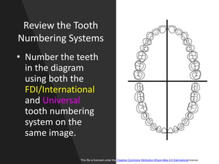 Review the Tooth
Numbering Systems
• Number the teeth
in the diagram
using both the
FDI/International
and Universal
tooth numbering
system on the
same image.
This file is licensed under the Creative Commons Attribution-Share Alike 4.0 International license.
 