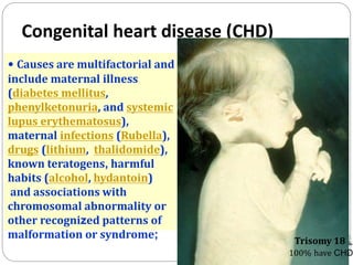 Congenital heart disease (CHD)
• Causes are multifactorial and
include maternal illness
(diabetes mellitus,
phenylketonuria, and systemic
lupus erythematosus),
maternal infections (Rubella),
drugs (lithium, thalidomide),
known teratogens, harmful
habits (alcohol, hydantoin)
and associations with
chromosomal abnormality or
other recognized patterns of
malformation or syndrome; Trisomy 18
100% have CHD
 