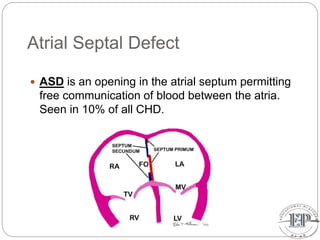 Atrial Septal Defect
 ASD is an opening in the atrial septum permitting
free communication of blood between the atria.
Seen in 10% of all CHD.
 