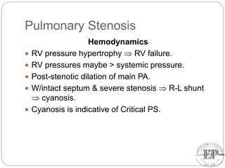 Pulmonary Stenosis
Hemodynamics
 RV pressure hypertrophy  RV failure.
 RV pressures maybe > systemic pressure.
 Post-stenotic dilation of main PA.
 W/intact septum & severe stenosis  R-L shunt
 cyanosis.
 Cyanosis is indicative of Critical PS.
 