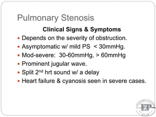 Pulmonary Stenosis
Clinical Signs & Symptoms
 Depends on the severity of obstruction.
 Asymptomatic w/ mild PS < 30mmHg.
 Mod-severe: 30-60mmHg, > 60mmHg
 Prominent jugular wave.
 Split 2nd hrt sound w/ a delay
 Heart failure & cyanosis seen in severe cases.
 