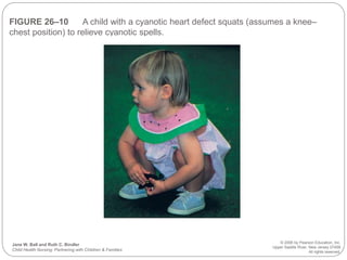 FIGURE 26–10 A child with a cyanotic heart defect squats (assumes a knee–
chest position) to relieve cyanotic spells.
Jane W. Ball and Ruth C. Bindler
Child Health Nursing: Partnering with Children & Families
© 2006 by Pearson Education, Inc.
Upper Saddle River, New Jersey 07458
All rights reserved.
 