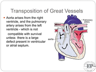 Transposition of Great Vessels
 Aorta arises from the right
ventricle, and the pulmonary
artery arises from the left
ventricle - which is not
compatible with survival
unless there is a large
defect present in ventricular
or atrial septum.
artery
aorta
 