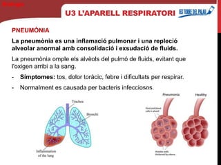 U3 L’APARELL RESPIRATORI
PNEUMÒNIA
La pneumònia es una inflamació pulmonar i una repleció
alveolar anormal amb consolidació i exsudació de fluids.
La pneumònia omple els alvèols del pulmó de fluids, evitant que
l'oxigen arribi a la sang.
- Símptomes: tos, dolor toràcic, febre i dificultats per respirar.
- Normalment es causada per bacteris infecciosos.
Biología
 