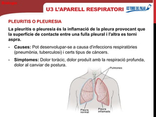 U3 L’APARELL RESPIRATORI
PLEURITIS O PLEURESIA
La pleuritis o pleuresia és la inflamació de la pleura provocant que
la superfície de contacte entre una fulla pleural i l'altra es torni
aspra.
- Causes: Pot desenvolupar-se a causa d'infeccions respiratòries
(pneumònia, tuberculosi) i certs tipus de càncers.
- Símptomes: Dolor toràcic, dolor produït amb la respiració profunda,
dolor al canviar de postura.
Biología
 