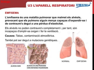 U3 L’APARELL RESPIRATORI
EMFISEMA
L'emfisema és una malaltia pulmonar que malmet els alvèols,
provocant que els pulmons siguin menys capaços d'expandir-se i
de contraure's degut a una pèrdua d'elasticitat.
Els alvèols no poden contraure's completament i, per tant, són
incapaços d'omplir-se oxigen i fer la ventilació.
Causes: Tabac, contaminació atmosfèrica.
També pot ser degut a mutacions genètiques.
Biología
NORMAL EMFISEMA
 