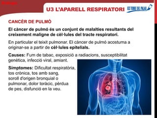 U3 L’APARELL RESPIRATORI
CANCÈR DE PULMÓ
El càncer de pulmó és un conjunt de malalties resultants del
creixement maligne de cèl·lules del tracte respiratori.
En particular el teixit pulmonar. El càncer de pulmó acostuma a
originar-se a partir de cèl·lules epitelials.
Causes: Fum de tabac, exposició a radiacions, susceptibilitat
genètica, infecció viral, amiant.
Símptomes: Dificultat respiratòria,
tos crònica, tos amb sang,
soroll d'origen bronquial o
pulmonar, dolor toràcic, pèrdua
de pes, disfunció en la veu.
Biología
 
