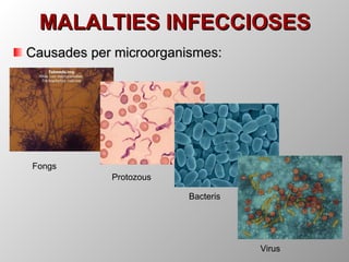 MALALTIES INFECCIOSES Causades per microorganismes: Fongs Protozous Bacteris Virus 