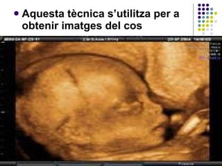 Aquesta tècnica s’utilitza per a obtenir imatges del cos 